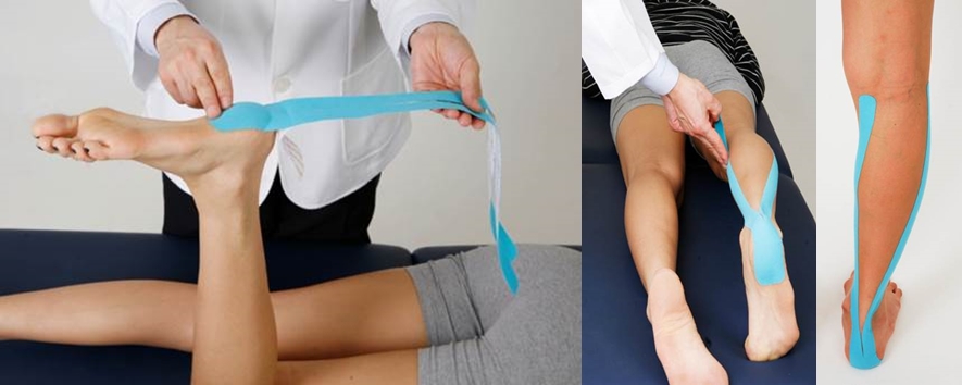 다리에 쥐가 나기 전 테이핑을 하는 것도 좋은 방법이다.